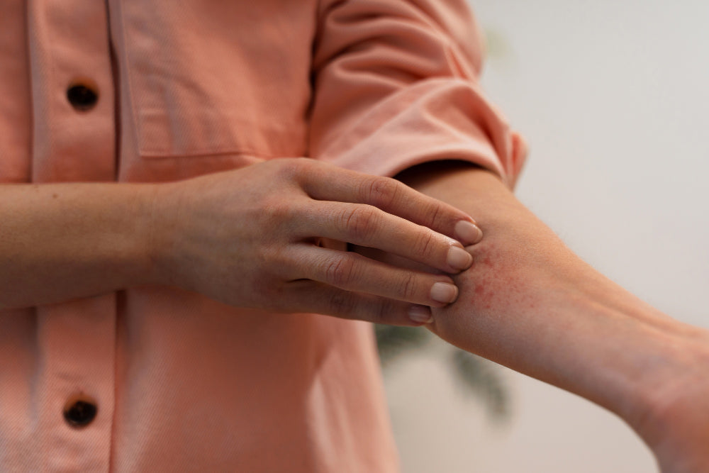 Woman scratching irritated skin on her arm due to eczema