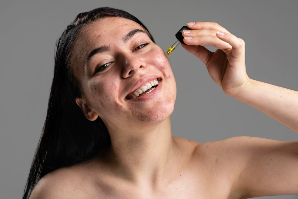 vitamin c serum for acne scars