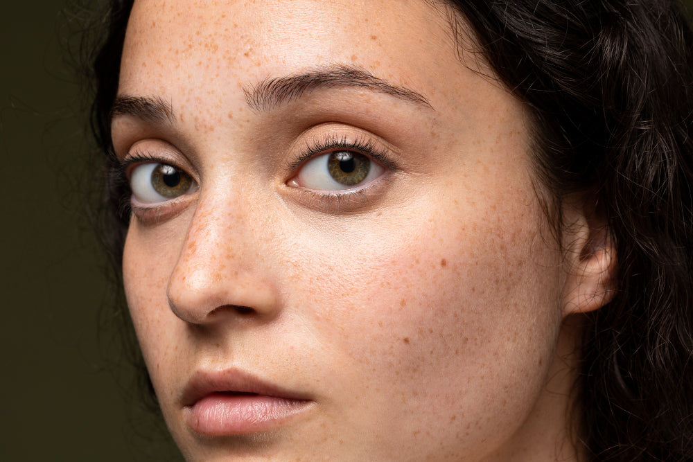 vitamin c serum hyperpigmentation