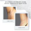 The Bright Starter Kit-Dark Spot Pigmentation-Excess Odor