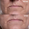 Wrinkles Schminkles: Mouth & Lip Wrinkle Smoothing Patches